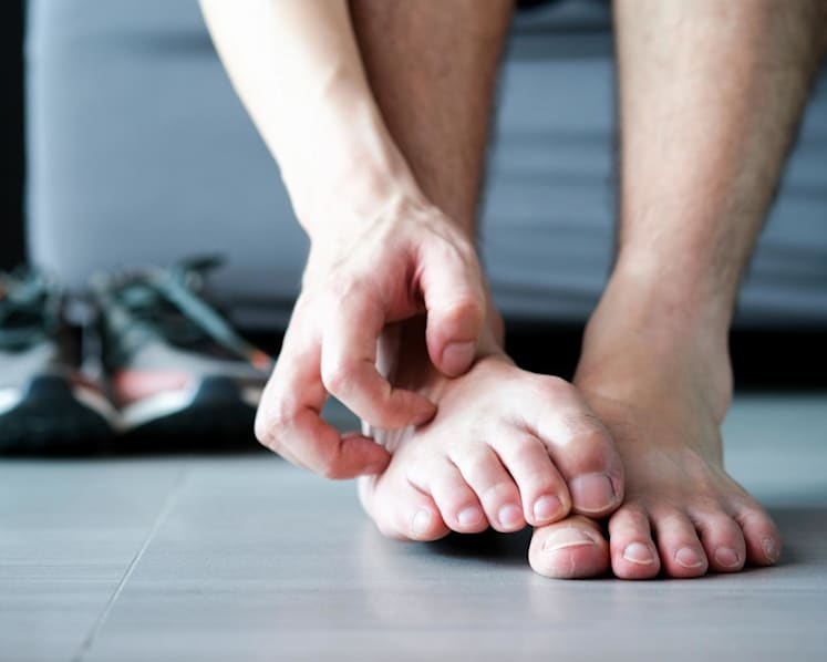 Why your athlete’s foot won’t go away – and how to finally clear it