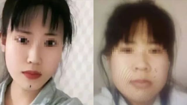 24岁女孩花近4万元整形 出院当天直接投河