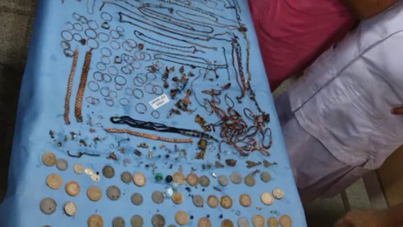 1.6kg logam termasuk barang kemas dikeluarkan dari perut wanita 1.6kg logam termasuk barang kemas dikeluarkan dari perut wanita
