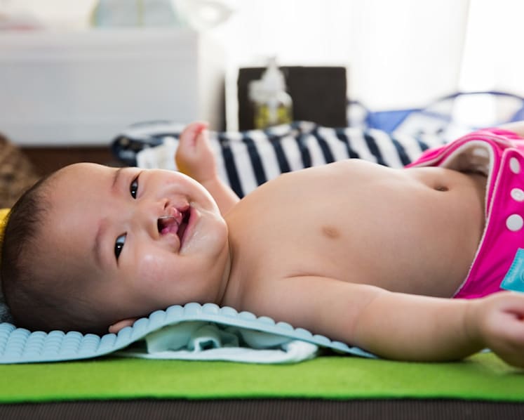 Mum overcomes despair to help other parents of children with cleft lip