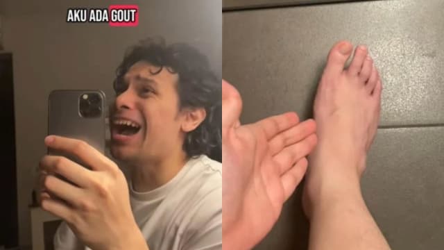 为健身狂吃红肉少喝水 马国男28岁就痛风缠身