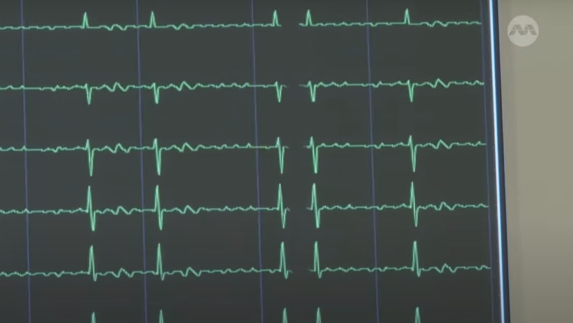 Heart attacks remain on the rise in Singapore; experts say prudent to control risk factors