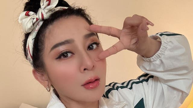 王彩桦医美过度　老公吓到认不出