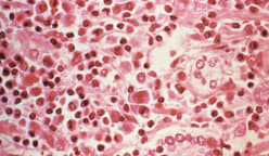 jelasBERITA: Apa itu hantavirus?