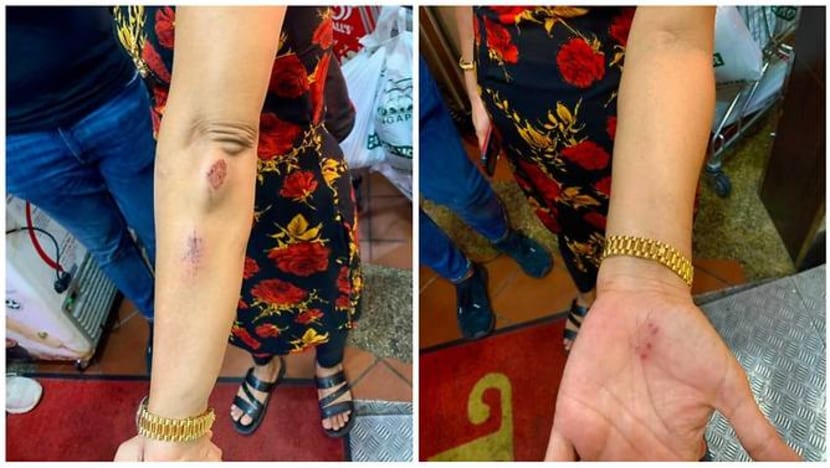 Police investigating case of a man who allegedly used racial slurs, kicked woman for not wearing mask