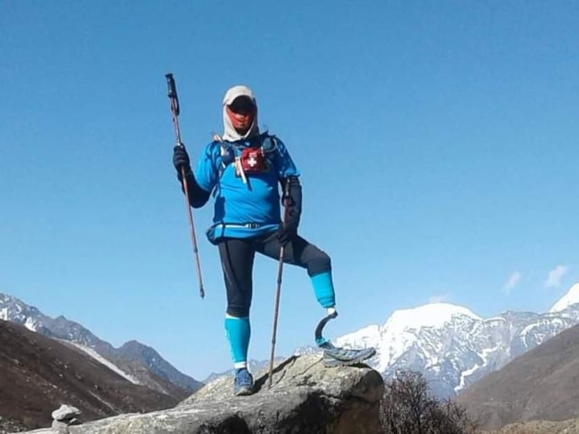 Commentary: Losing a limb to diabetes is painful but not the end of the road