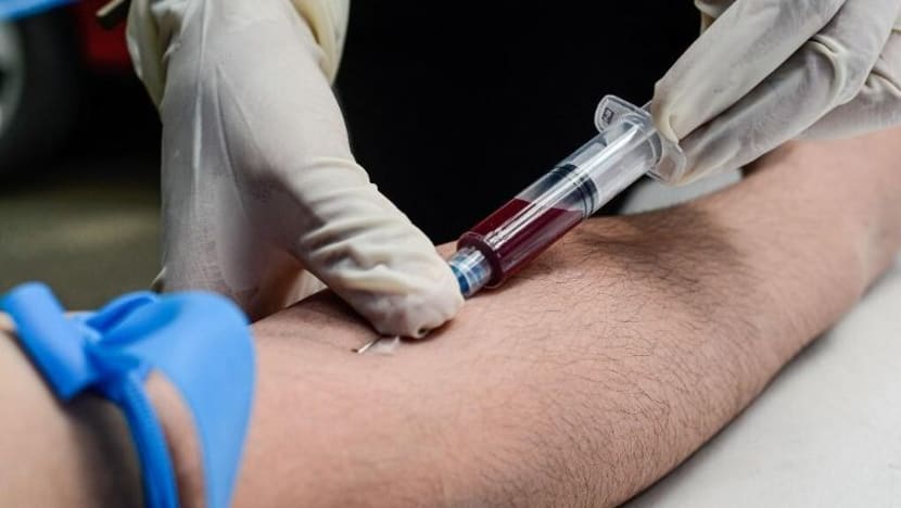 198 kes baru HIV dilapor di S'pura antara Jan-Okt