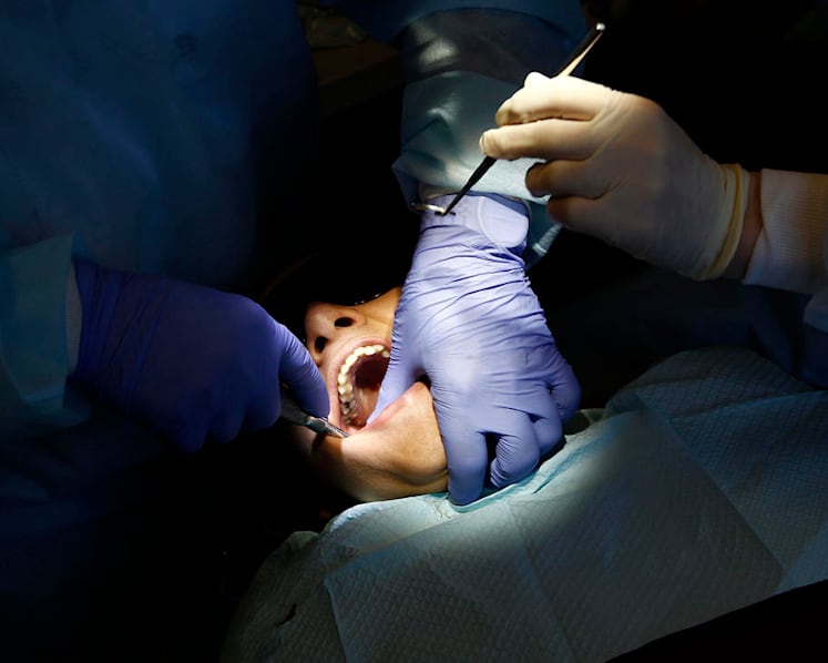 Wisdom tooth extraction damages ex-chef’s taste buds; dentist to pay S$105,000 in compensation