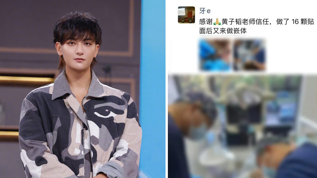 Huang Zitao Calls Out Dental Clinic For Allegedly Sharing Treatment Photos Without Consent