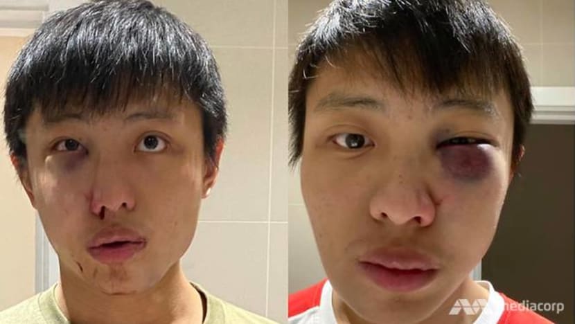 Singaporean student in London says he was assaulted after reacting to Covid-19 comments