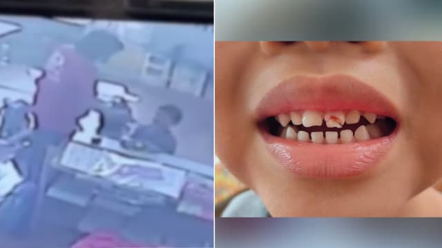 拿铁汤匙打断幼童门牙 台湾幼儿园老师被开除