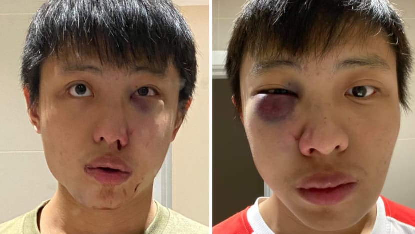 Singapore High Commission 'deeply disturbed' by alleged racist assault on student in London