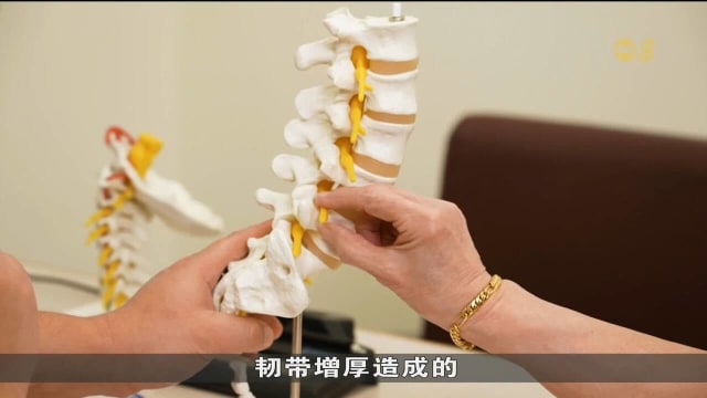 腰椎管狭窄症困扰50岁以上人群 专家建议提早诊断
