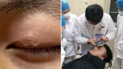 Related article image