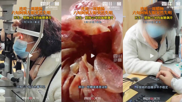 中国女子连吃一周腊肠左眼忽然失明！