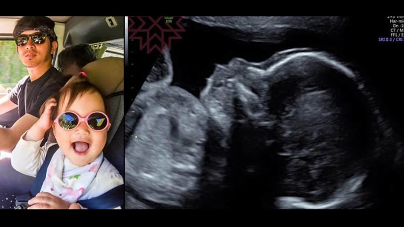 Chris Wang expecting baby number two