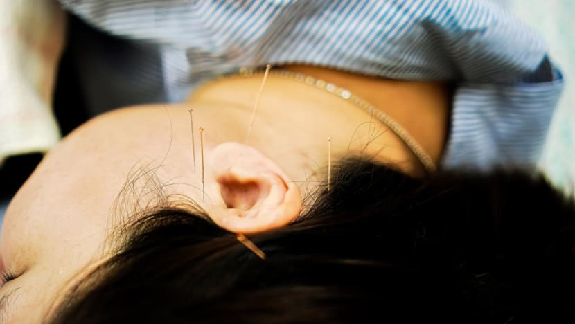 TCM practitioner suspended after needles left in patient's head, toe following acupuncture treatment