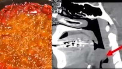 Woman, 26, Gets Bad Sore Throat After Having Mala Hot Pot, Dies The Next Day