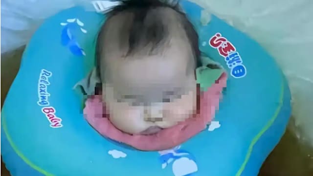 云南四月大女婴泡药浴后身亡  警方市监介入查死因