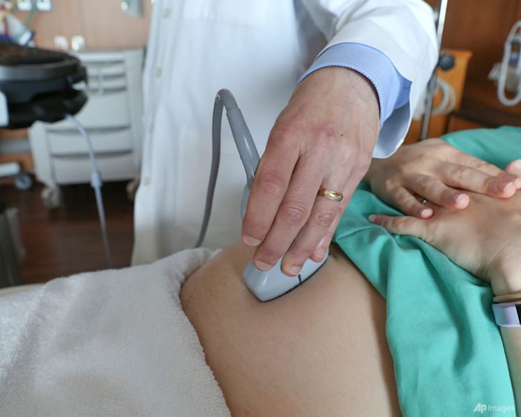 US maternal death rate rose slightly last year, health officials say