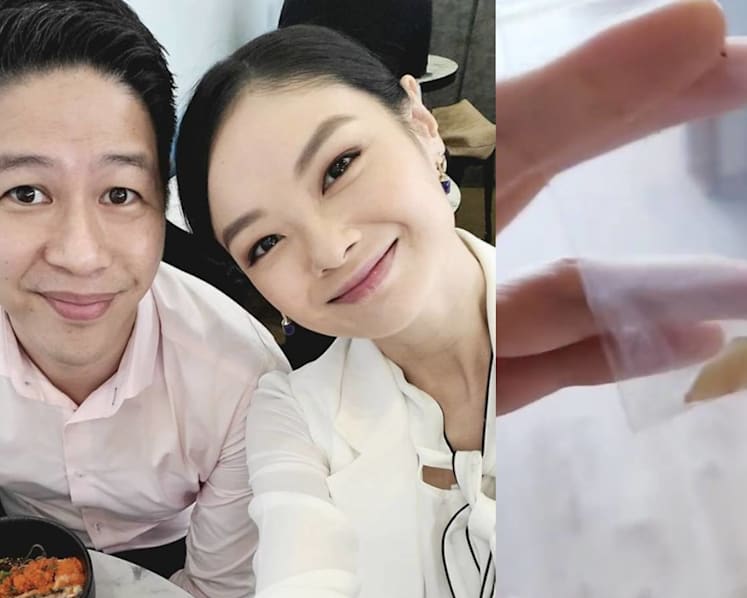 Sheila Sim Gave Her Husband Her Wisdom Tooth As A Present