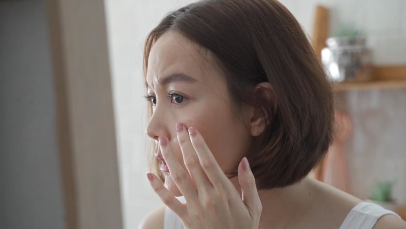Commentary: Wrinkles, and why they terrify my generation Commentary: Wrinkles, and why they terrify my generation