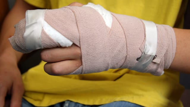 中国妈妈厨房做饭 意外砍断儿子三根手指