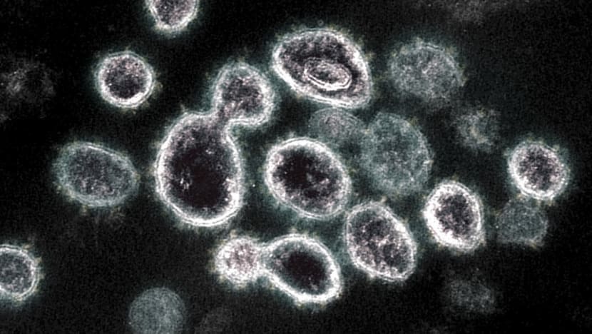 More than 8,800 COVID-19 reinfections in Singapore in about 5 months More than 8,800 COVID-19 reinfections in Singapore in about 5 months