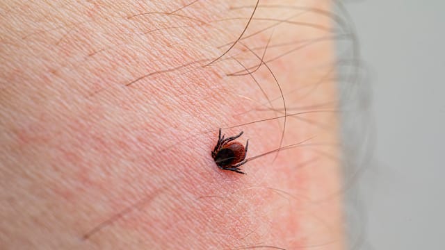 日本致命蜱虫传染病病例攀升 超越去年同期纪录