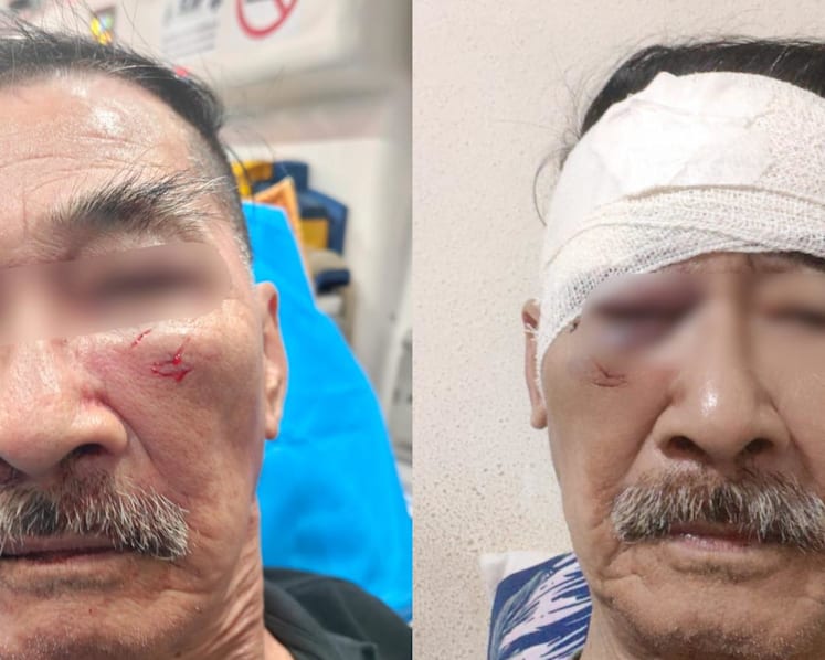 80-year-old security officer allegedly punched in the face while on duty at Bedok Central