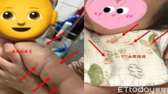 一个月内虐待六名儿童 台湾托育人员遭罚款
