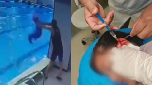 女童游泳课被教练抱摔致耳软骨断裂 场馆：只是玩耍