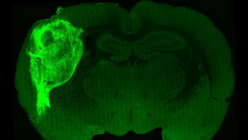 Commentary: Human mini-brains were transplanted into rats. Is this ethical? Commentary: Human mini-brains were transplanted into rats. Is this ethical?