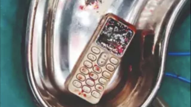 印度少女和兄弟吵架 气到把手机吞进肚