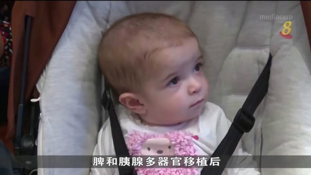 世界首例 西班牙一岁女童成功完成肠胃等器官移植