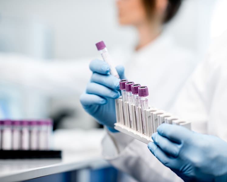 Commentary: Your leftover blood samples are valuable to science – but they are often discarded