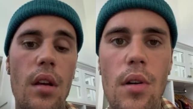 Justin Bieber惊爆罹罕病　“脸歪嘴斜”模样曝光