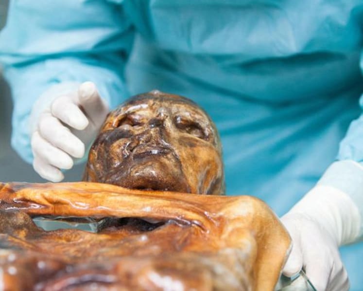 Scientists reveal Ötzi the Iceman's dynamic microbial world