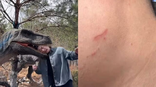 好奇将头伸入模型 中国男子被“恐龙”咬伤 