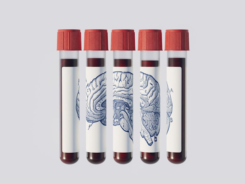 Could a blood test predict if you’ll get Alzheimer’s years before symptoms appear?
