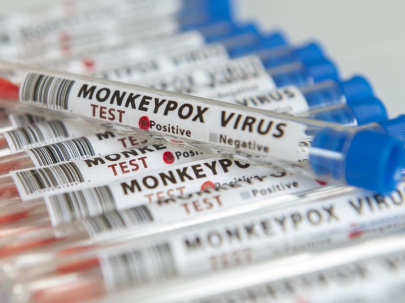 Monkeypox can cause symptoms such as fever, headaches, back pain, aching muscles and a general fatigue. Once the fever stops, a bumpy rash may develop on parts of the body.