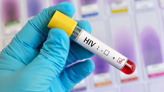 巴基斯坦医院重复使用针筒  331名儿童感染爱之病