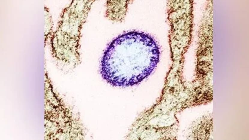 Thailand tingkatkan pengawasan terhadap situasi virus Nipah di India