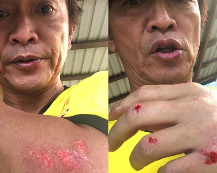 Jacky Wu Crashes Bike While Filming Variety Show; Says His Helmet