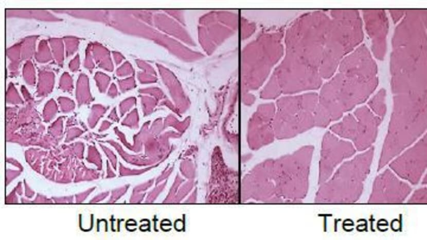 Scientists find way to help cancer patients suffering from terminal weight loss