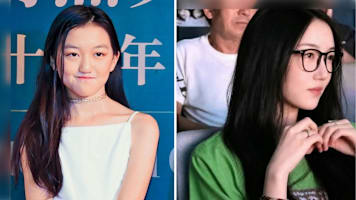 Faye wong daughter li yan cleft lip