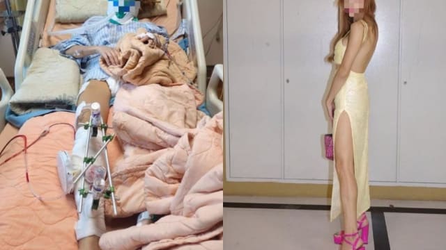 泰国女网红台湾遇车祸  被拖行数米惨断腿