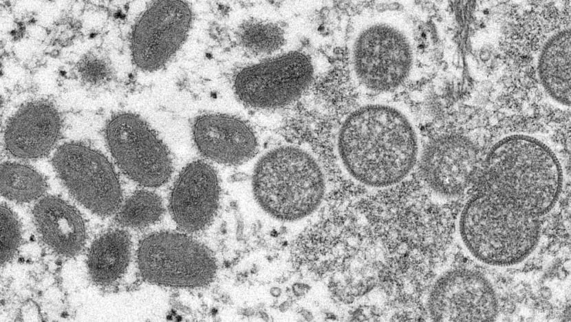Singapore confirms second local case of monkeypox infection Singapore confirms second local case of monkeypox infection