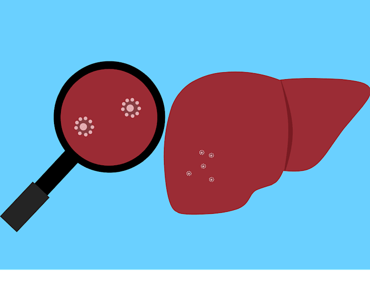 How much do you know about hepatitis B and what if you’re a silent ‘carrier’ of the virus?