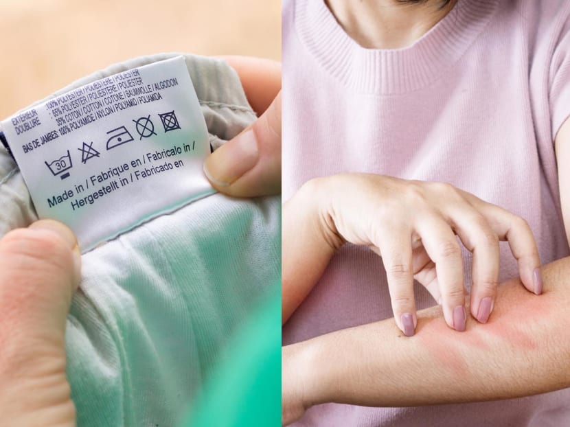 Do clothing labels, strong showers, and tight shorts and bras make your skin itchy and red? Here’s why Do clothing labels, strong showers, and tight shorts and bras make your skin itchy and red? Here’s why
